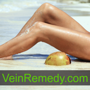Varicose Veins Stockings Place In Varicose Vein Treatments